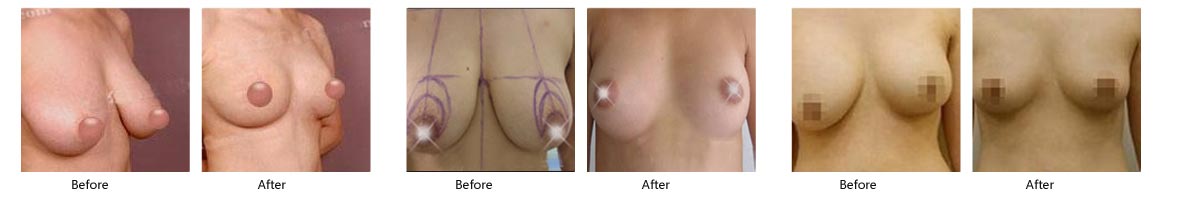 ������С����������Ч��